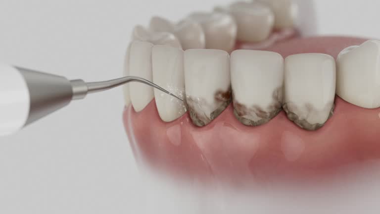 Reliable Teeth Cleaning And Checkup contractor in Pottawatomie County County, KS by Dentist Open Now